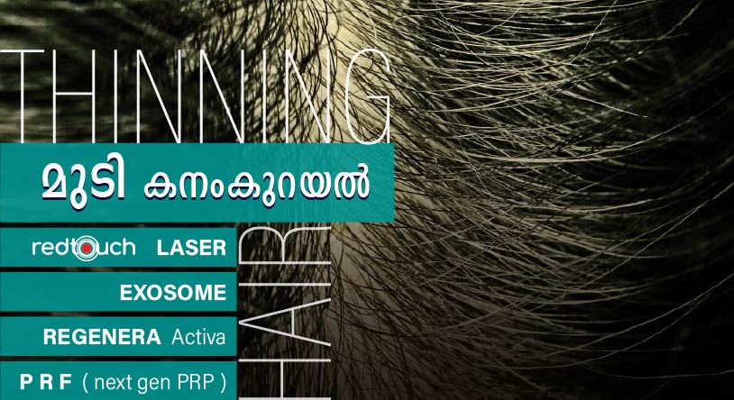 Lisa skin clinic, Calicut, Lisa-Hair-Treatments-REJUVENATION